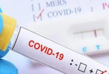 Photo of 21 New cases of Coronavirus in Northern Cyprus, and 8 recoveries